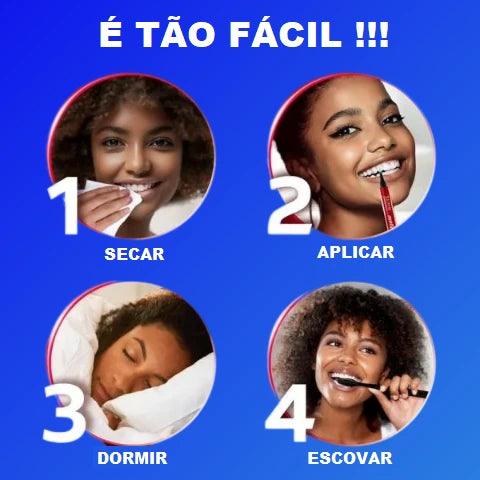 Caneta Branqueadora Dental SmileXpress 🔥 [PAGUE 2, LEVE 4] - iBuy™