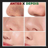 Peeling Adesivo Instantâneo Drop Clean - iBuy™